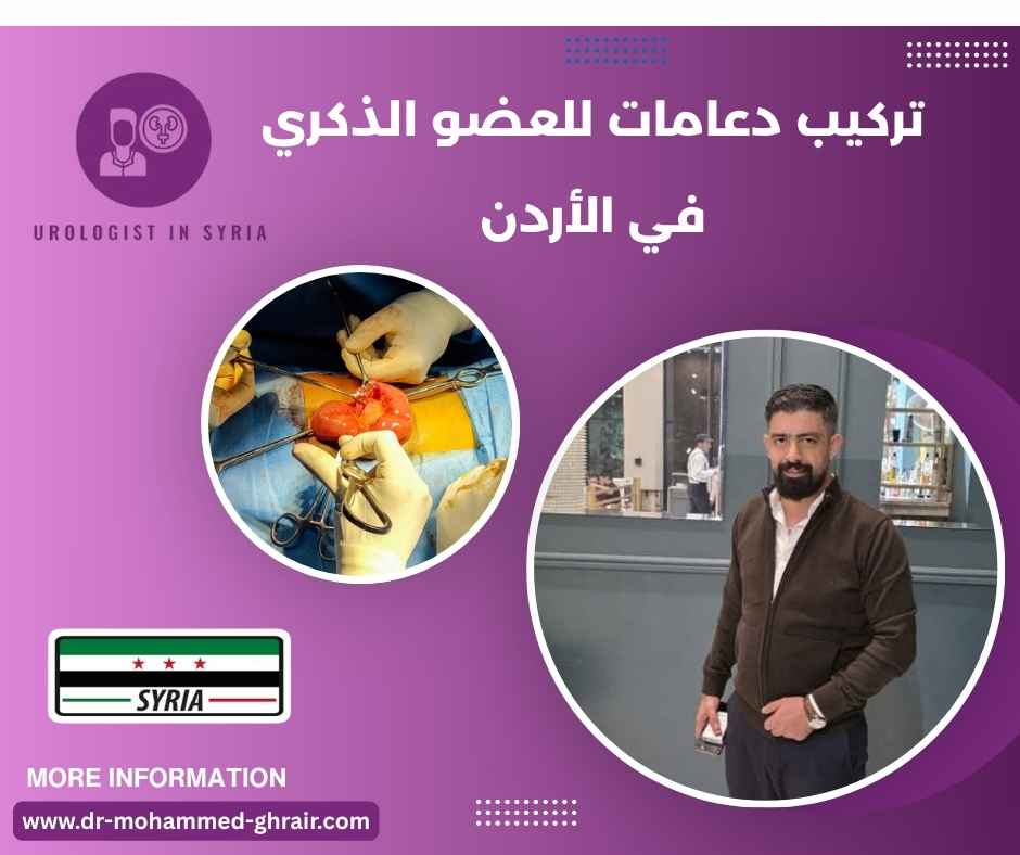 تركيب دعامات للعضو الذكري في الأردن