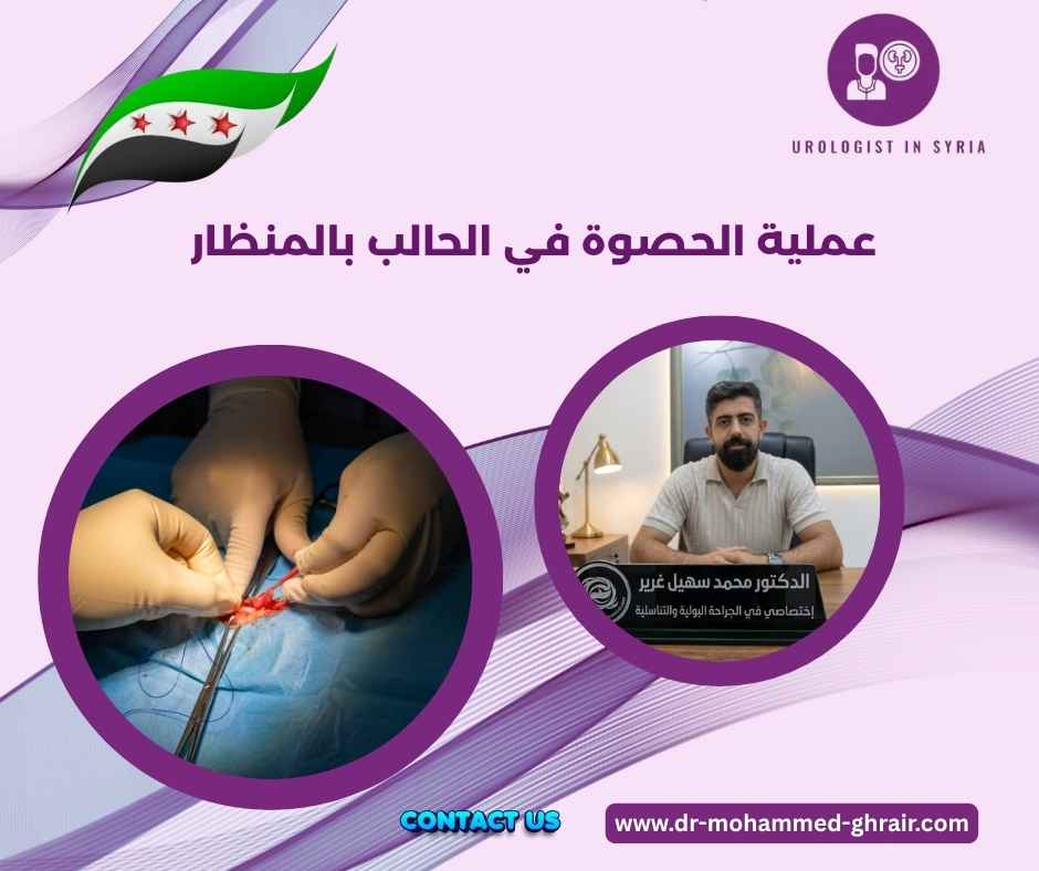 عملية الحصوة في الحالب بالمنظار