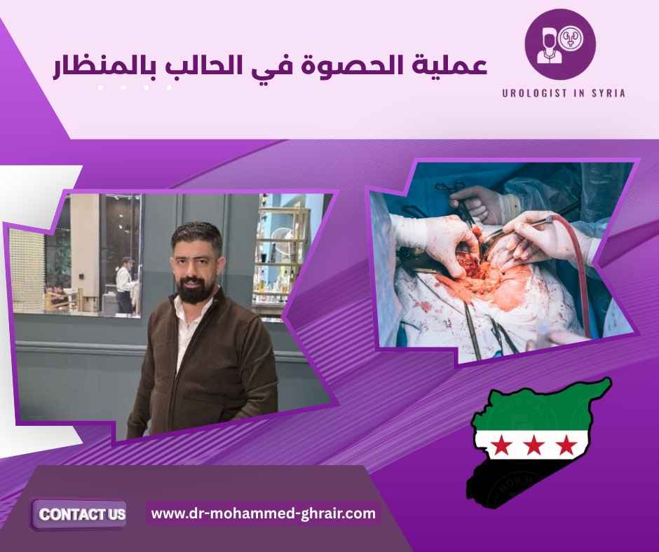 عملية الحصوة في الحالب بالمنظار