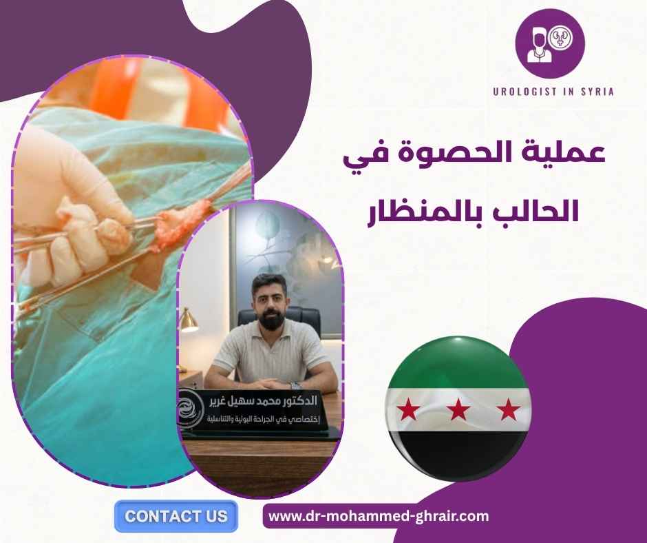 عملية الحصوة في الحالب بالمنظار