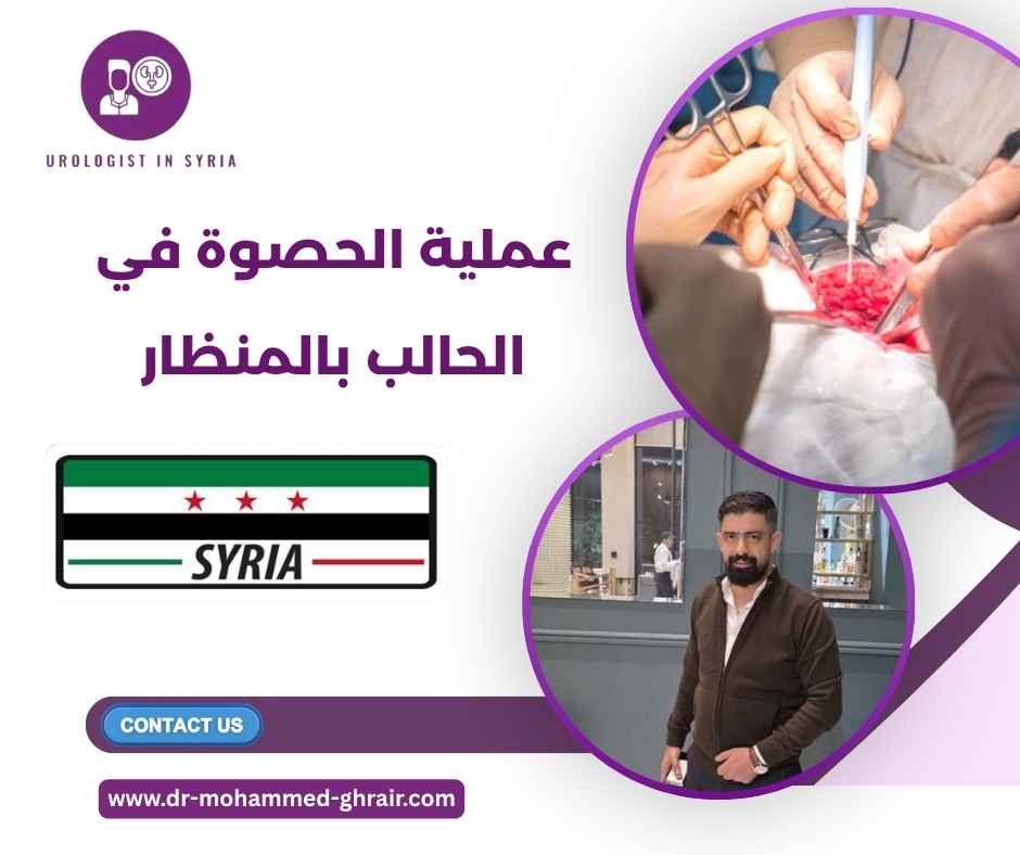 عملية الحصوة في الحالب بالمنظار