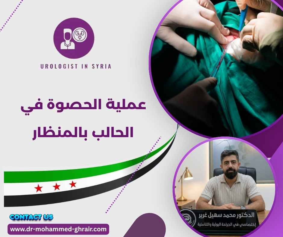 عملية الحصوة في الحالب بالمنظار