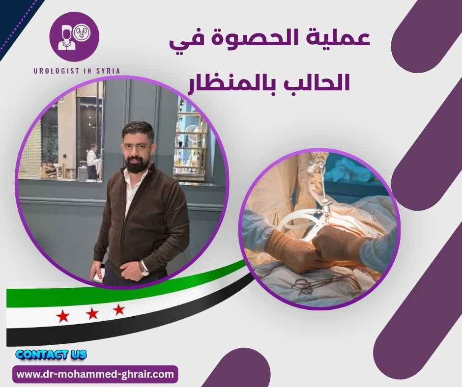 عملية الحصوة في الحالب بالمنظار