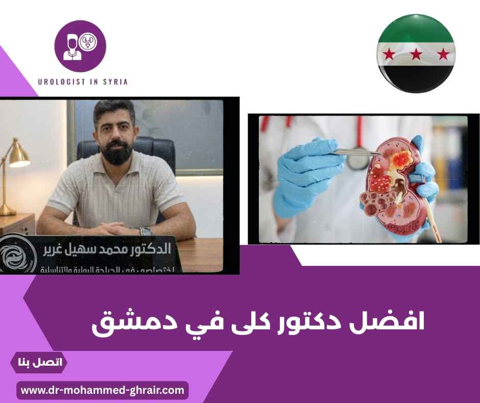 افضل دكتور كلى في دمشق 