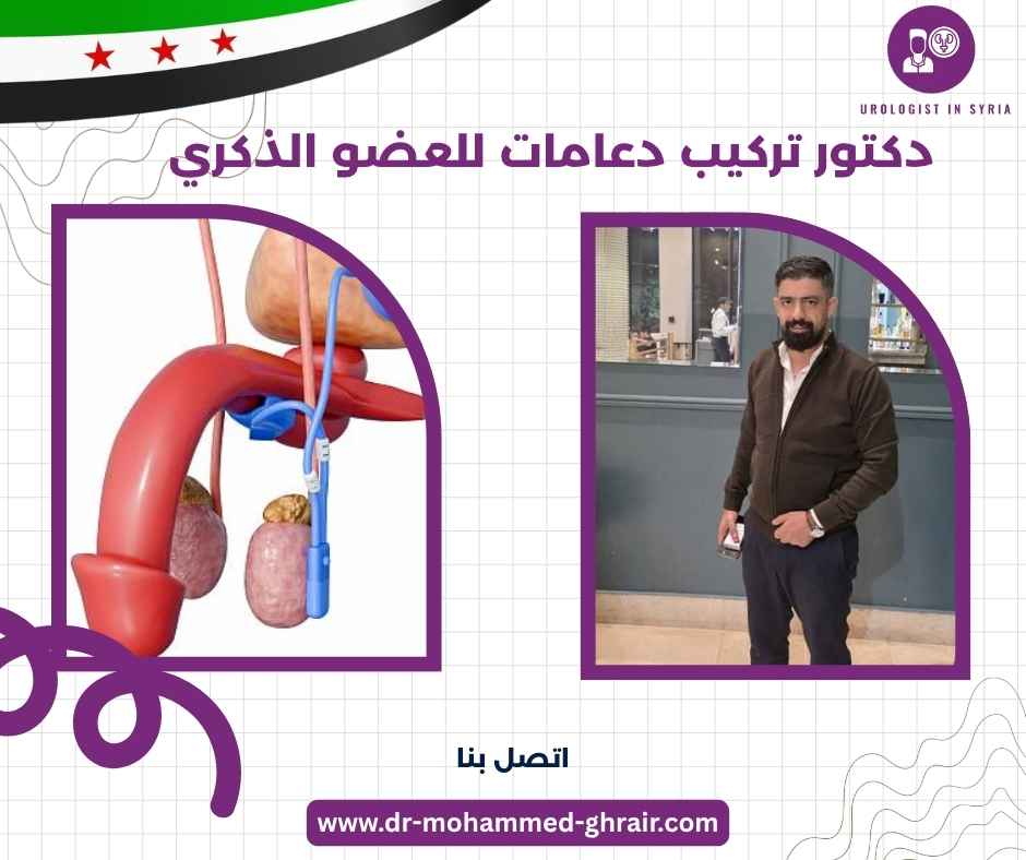 دكتور تركيب دعامات للعضو الذكري