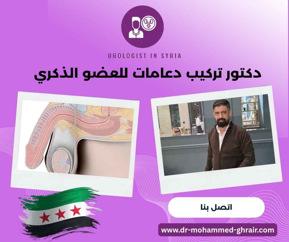 دكتور تركيب دعامات للعضو الذكري